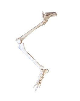 Lower Limb with Hip Bone Model AM-11130