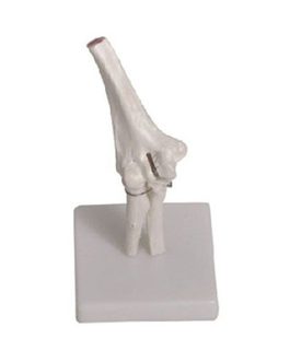 Elbow Joint Model AM-11201-2