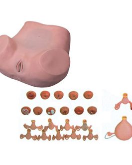 Gynecological Examination Model AM-7